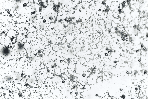 what do mold spores look like